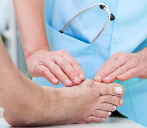 Hallux Valgus Behandlung in Ortho Clinic Zürich